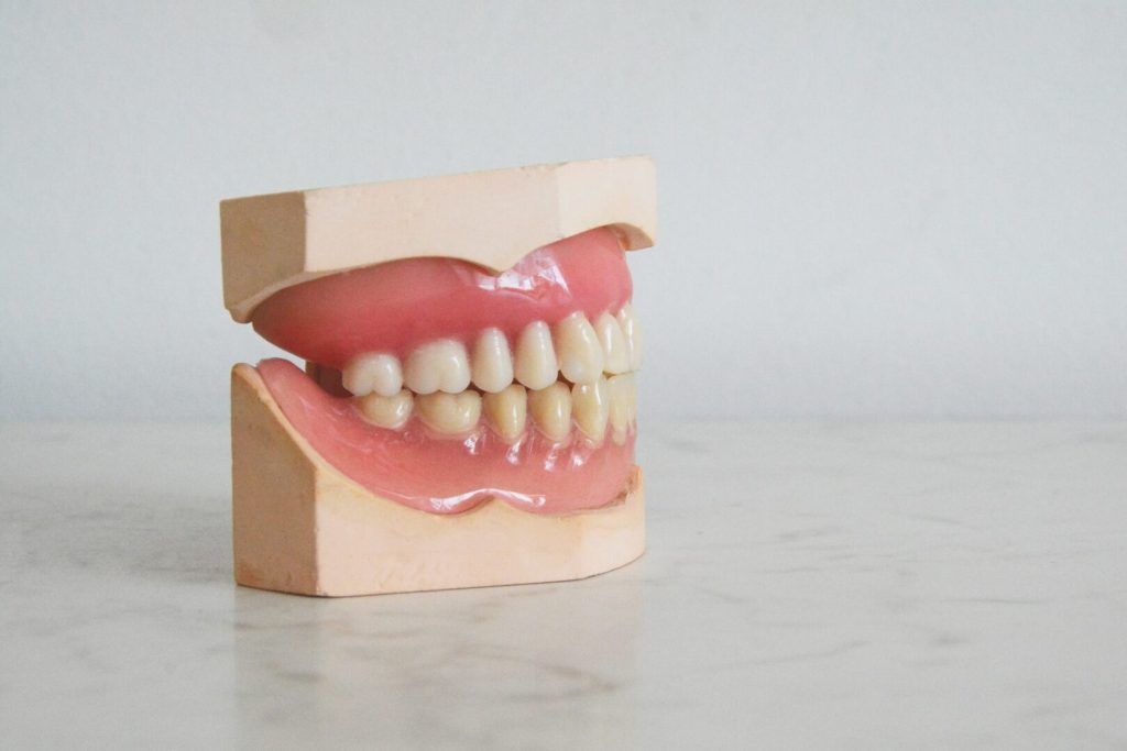 composite fillings