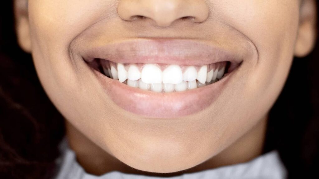 Porcelain Veneer Placement: A Game Changer for Your Smile