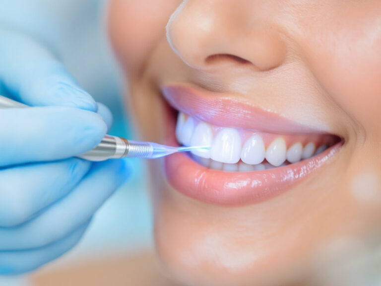 non-invasive cosmetic dental procedure