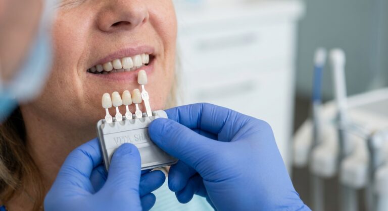 Dentist comparing shade guide and veneer samples to patient's teeth during smile makeover consultation